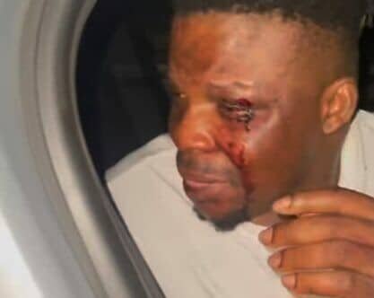 Ijoba Lande Accuses Lagos Police Of Brutal Assault, Theft